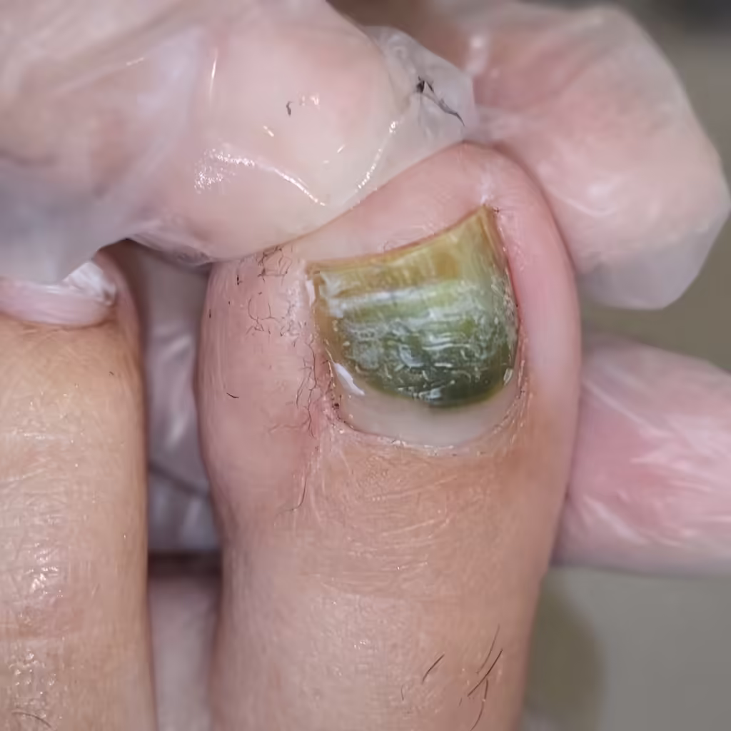 Green Nails 10