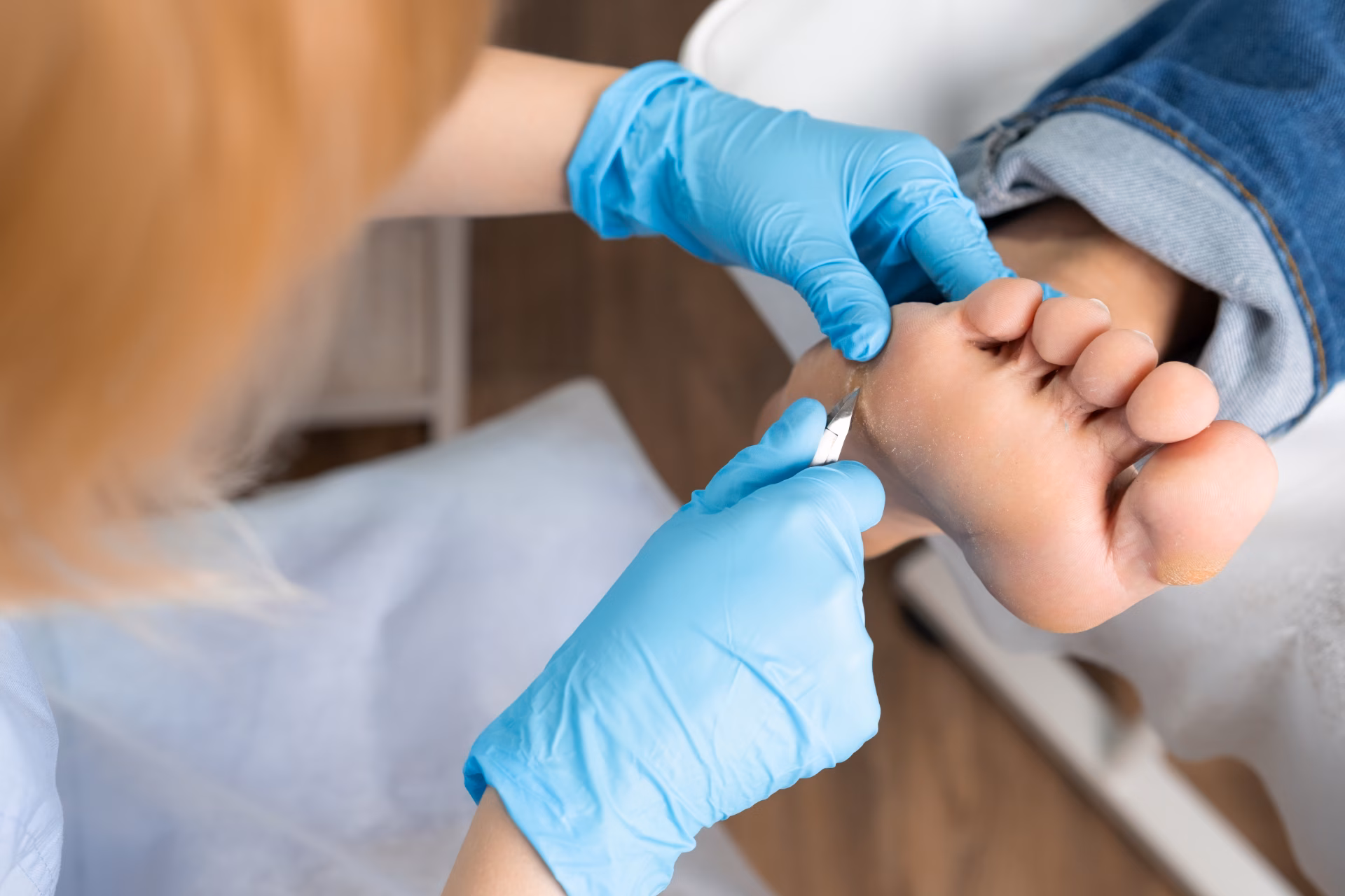 a podiatrist using clippers removes a callus from 2026 01 08 07 09 59 utc converted