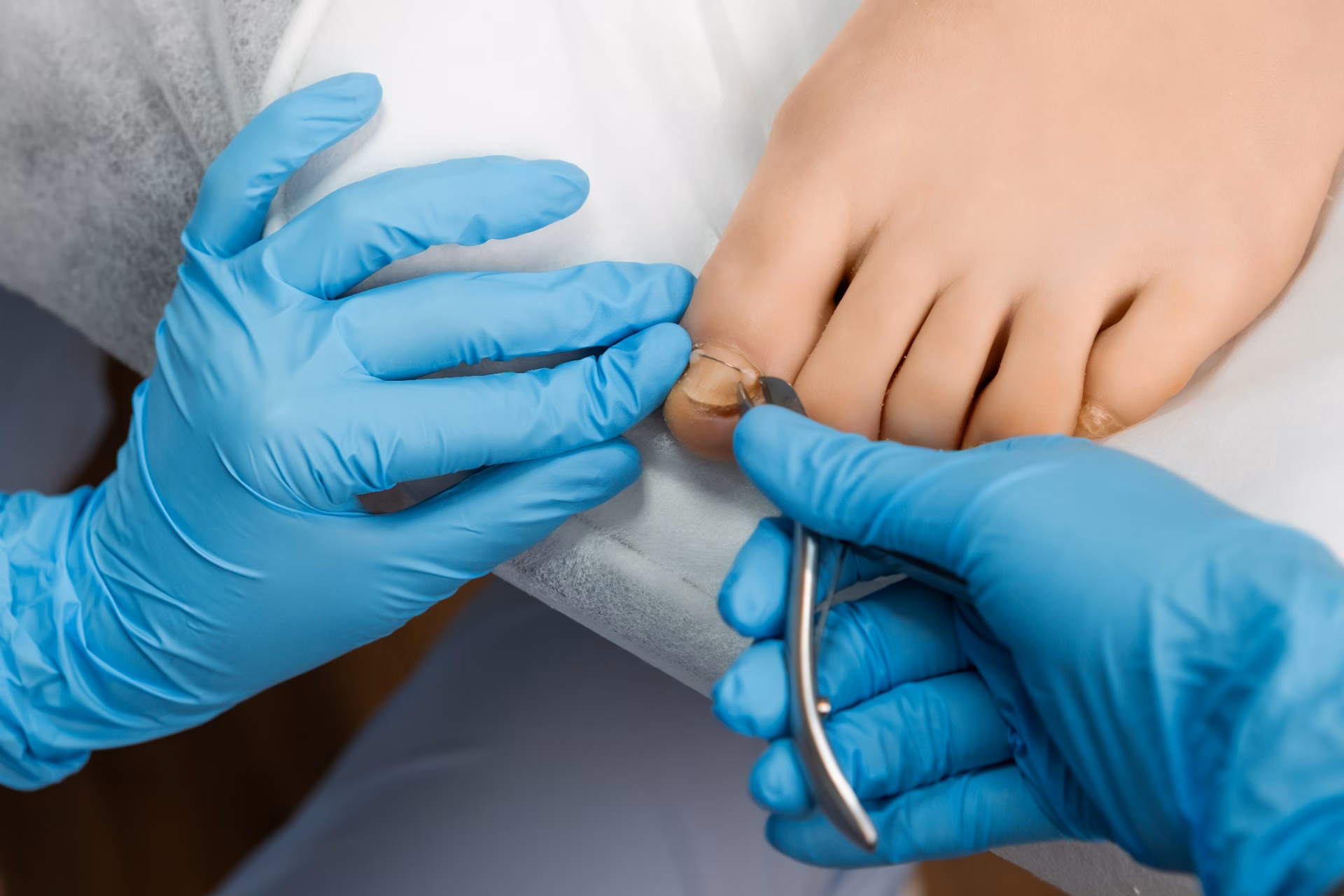 ingrown toenail procedure for female in beauty sal 2026 01 08 07 44 44 utc converted