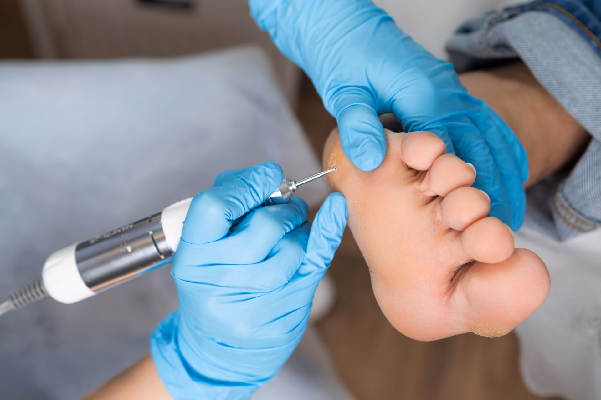professional removing a callus on a womans foot by 2026 01 08 22 30 44 utc converted