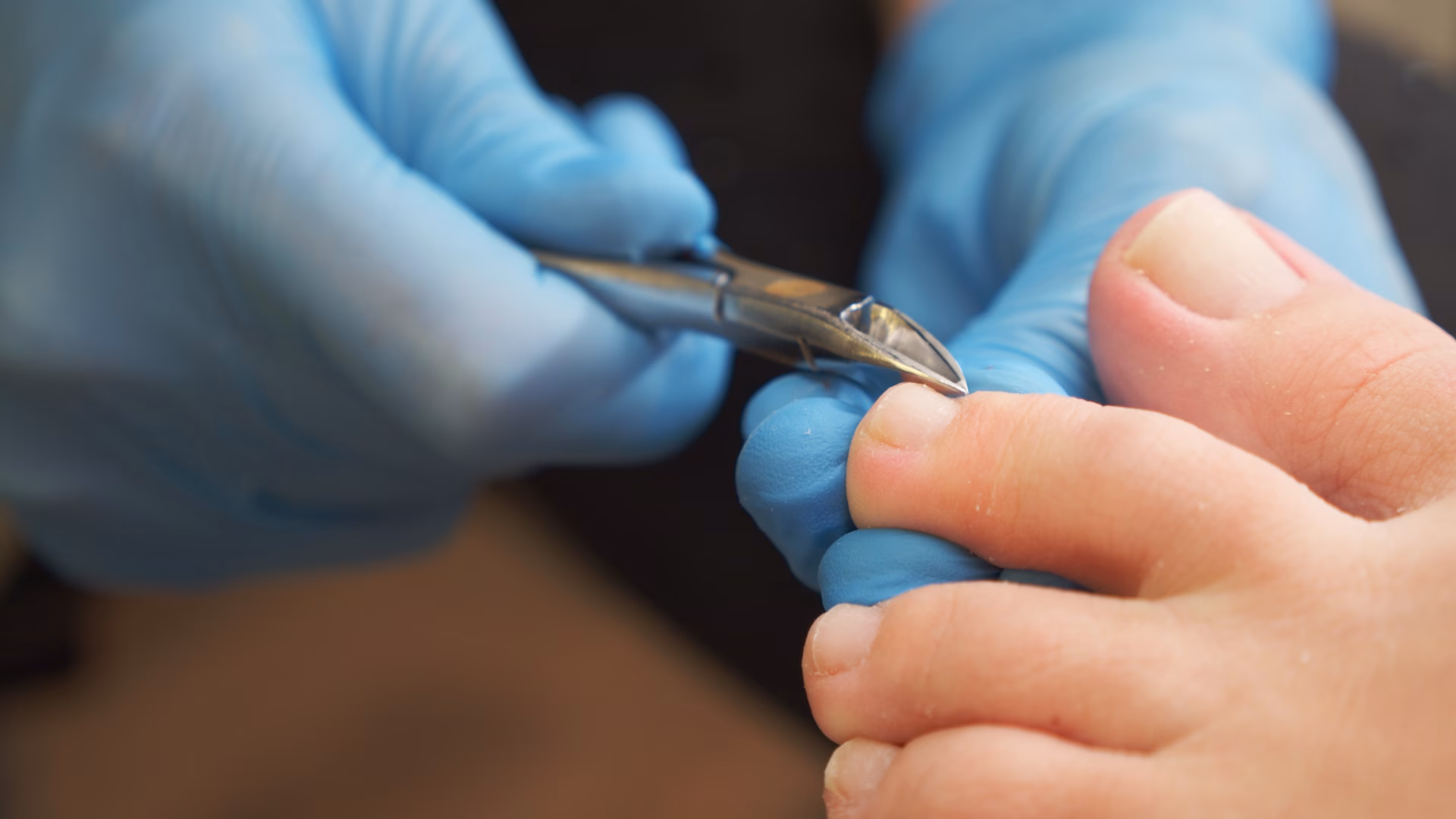 processing of rough cuticles of nails on leg wit 2026 01 07 05 52 52 utc converted