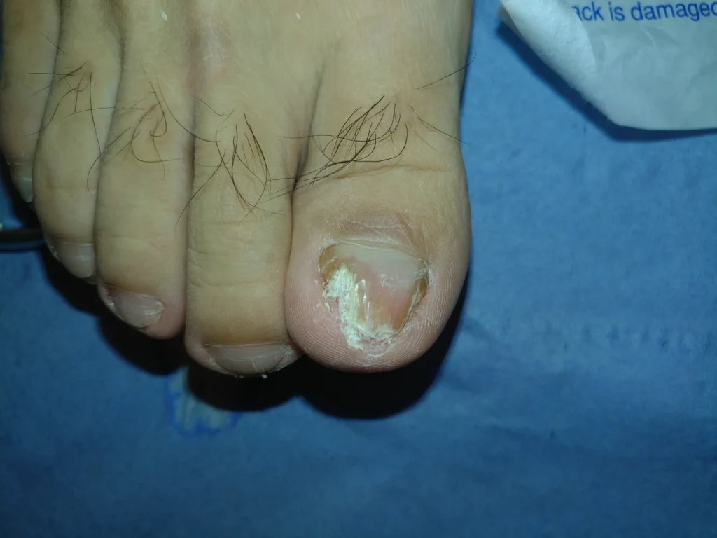 How to Choose the Right Clinic for Lunula Laser Treatment in London 9 e3893f 31dd8b284c1647358ac68b0b7ebc9df9mv2