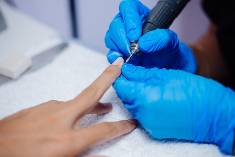 laser-fungal-nail-treatment