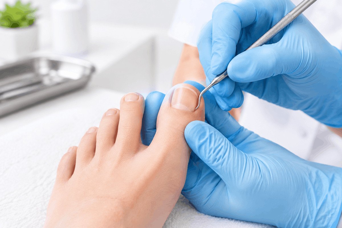 ingrown-nail-surgery